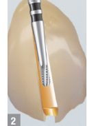 Edenta C34.314.012 koronafelvágó