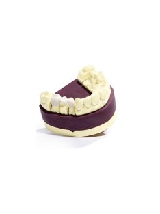 Dentona Zero  2x2,5kg gold-brown 0 expanziós 12001
